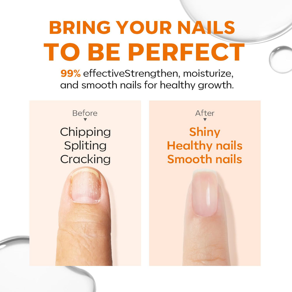modelones damaged nails close-up highlights ridge filling for healthier look.