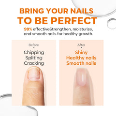 modelones damaged nails close-up highlights ridge filling for healthier look.