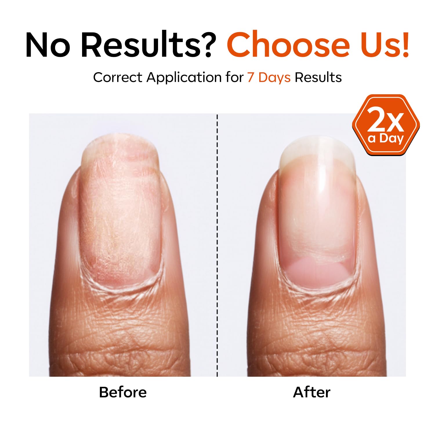 Modelones base coat function fills ridges for a smoother nail surface.