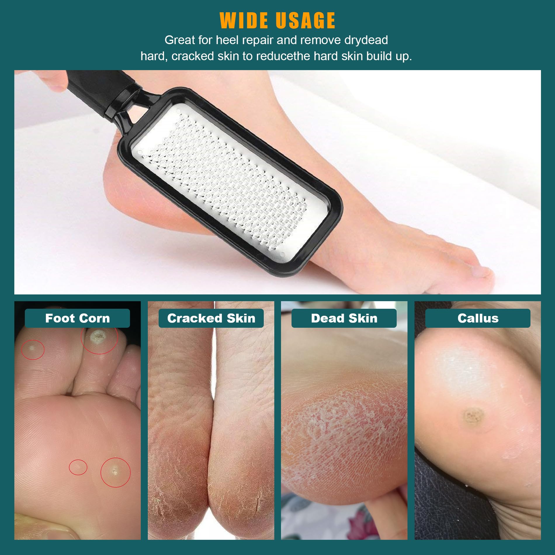 MODENGKONGJIAN professional foot care tool for spa-like maintenance at home