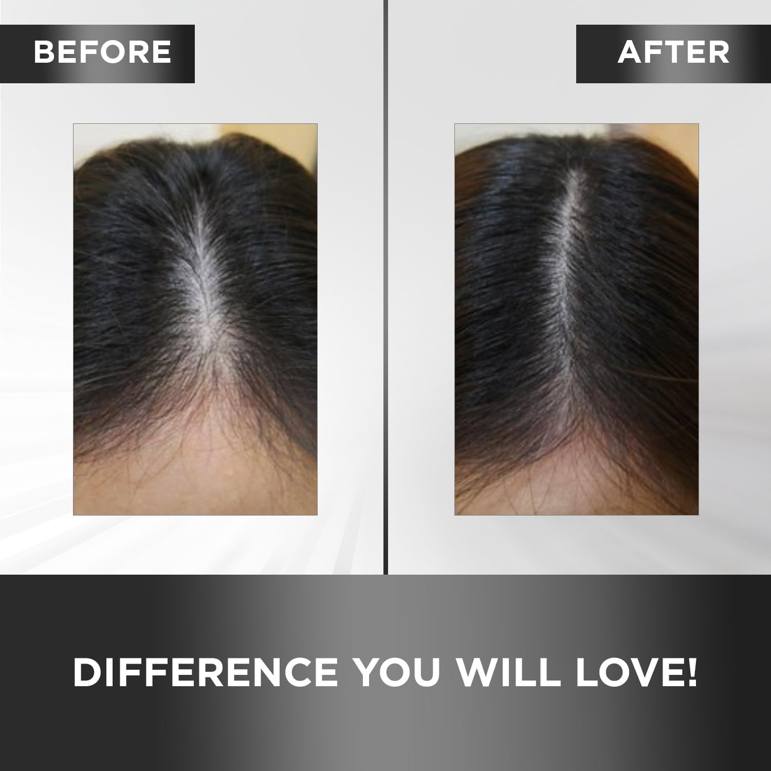 MOEHAIR Hair Guard Tonic featuring ginseng supports healthy roots and scalp vitality.