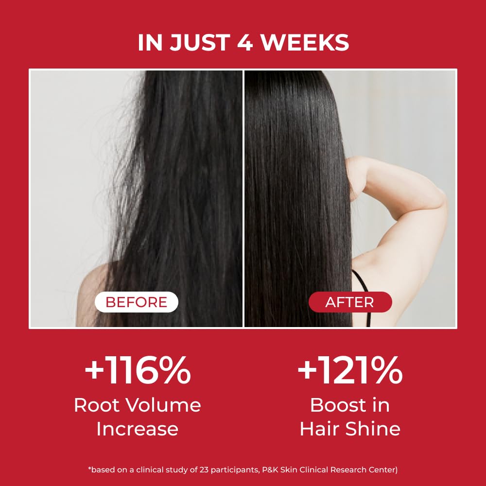 MOEV Annurcatin Shampoo label detail emphasizes natural annurca apple extract.