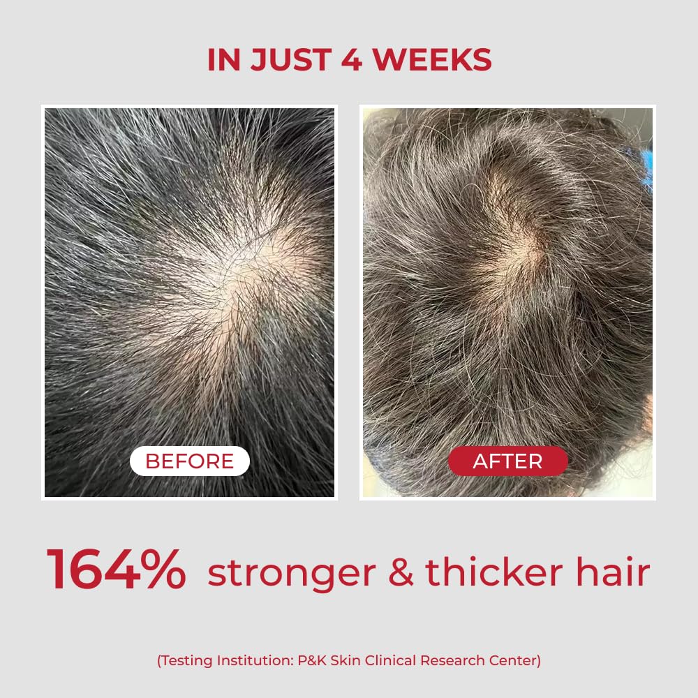 Hands massaging MOEV ANNURCATIN into the scalp for cleansing.