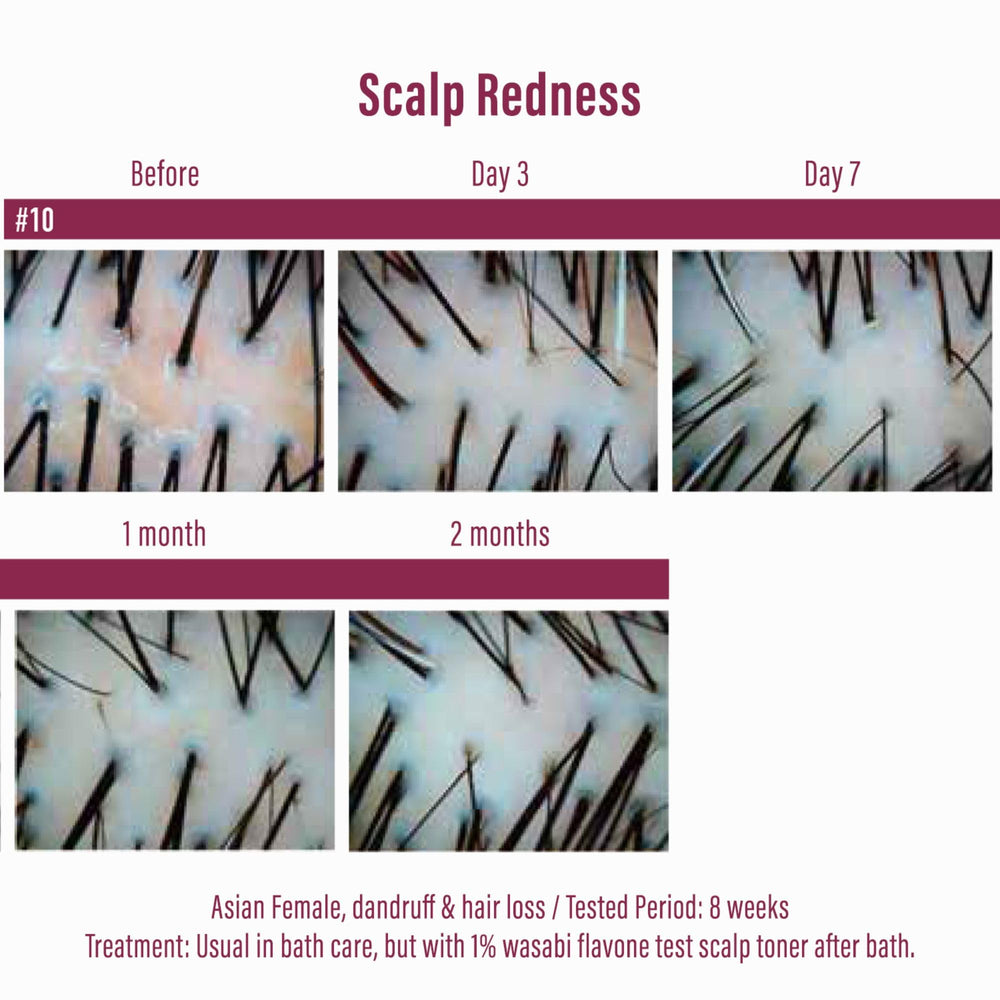 Moist Diane Wasabi Japonica essence image highlights scalp nourishment and aging support.