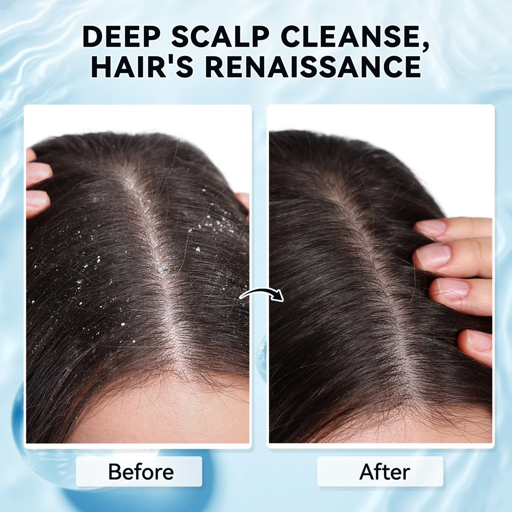 Lush foamy lather from Mokasakiso scalp scrub during wash