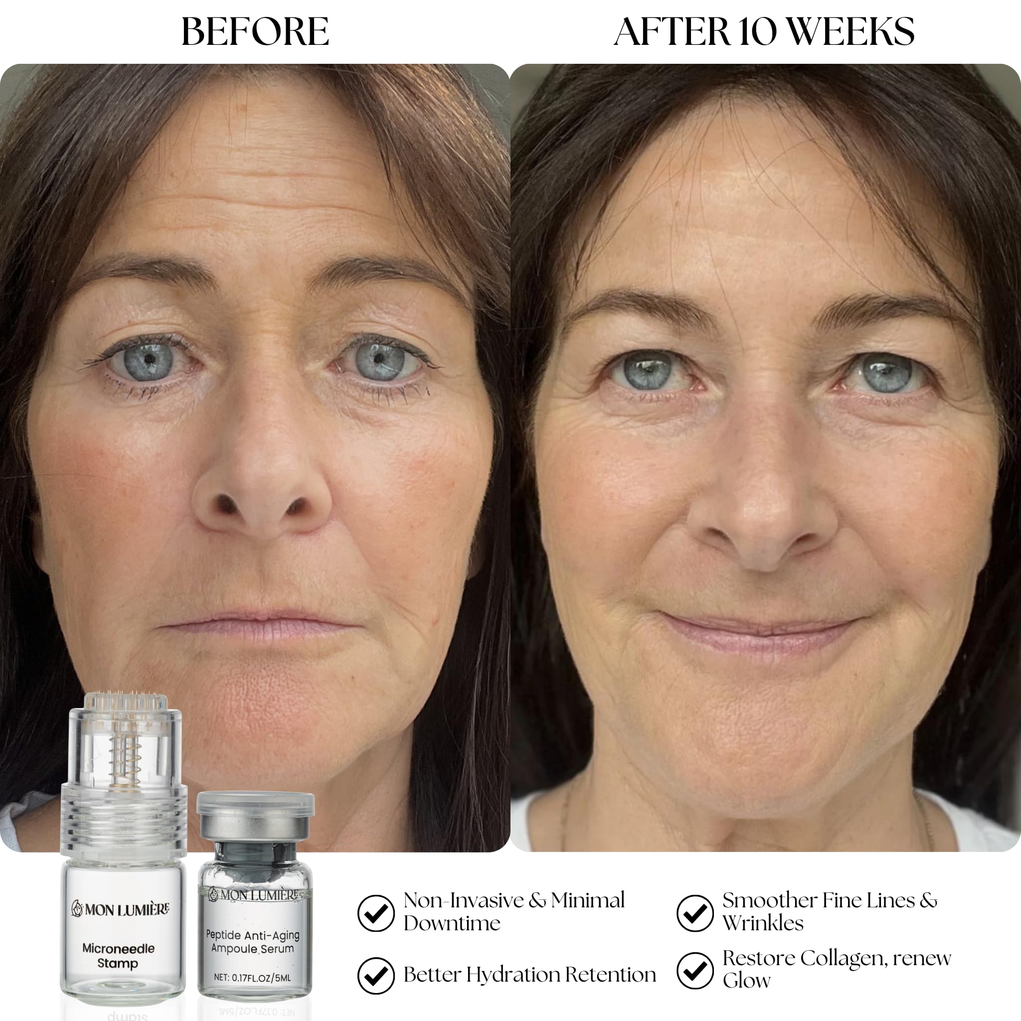 Mon Lumière ergothioneine-antioxydant : protection contre le stress environnemental.