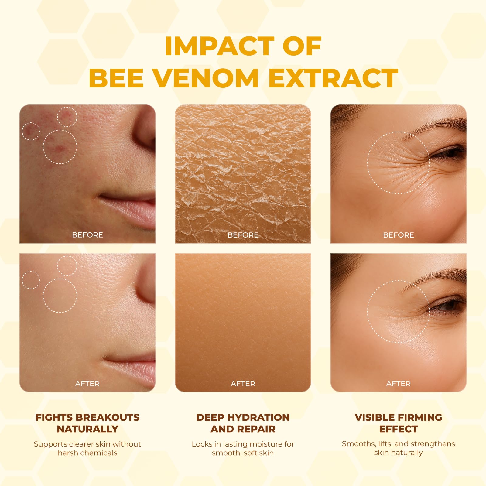 MONIER Bee Venom Cream closeup shows smoother skin texture.