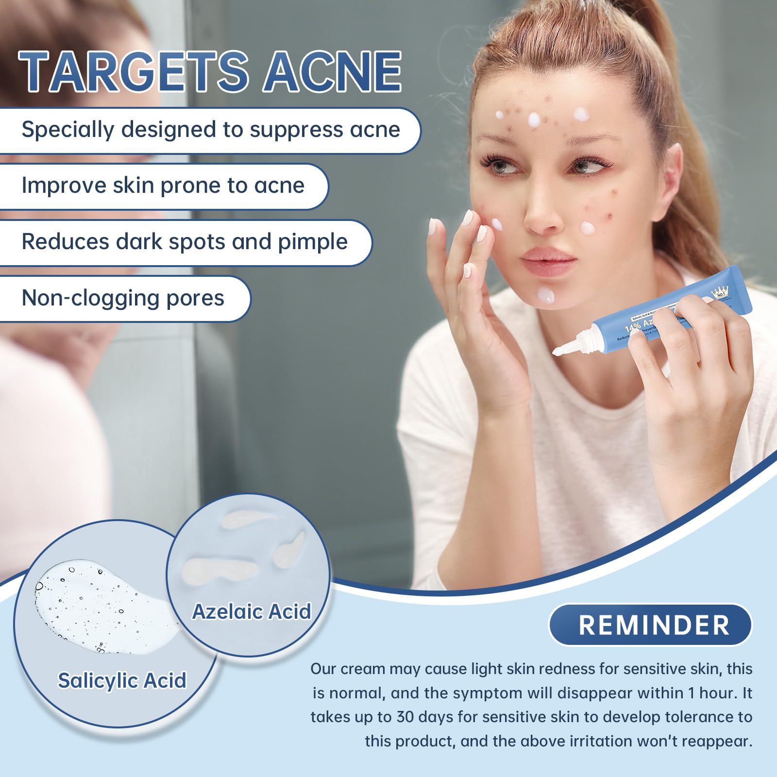 Mopayzer Azelaic Acid 14% Cream close-up texture reveals lightweight, breathable formula