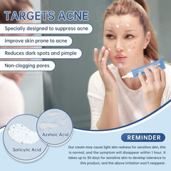 Mopayzer Azelaic Acid 14% Cream close-up texture reveals lightweight, breathable formula
