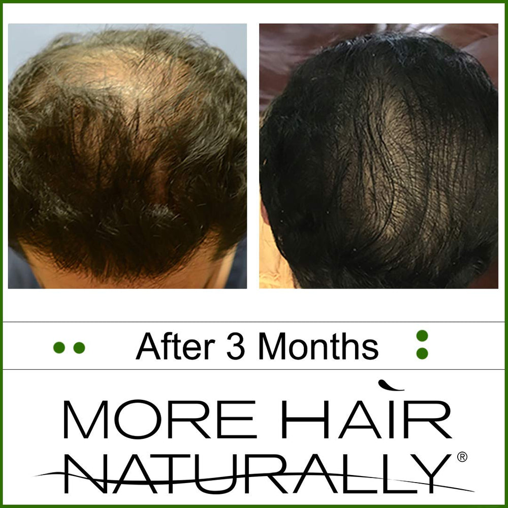 More Hair Naturally 9 bottle and packaging design emphasizes USA-made formulation.