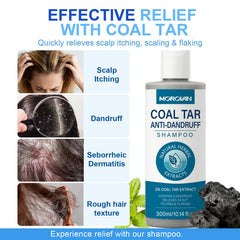Morovan Coal Tar Shampoo pour demonstrates easy application and scalp care.