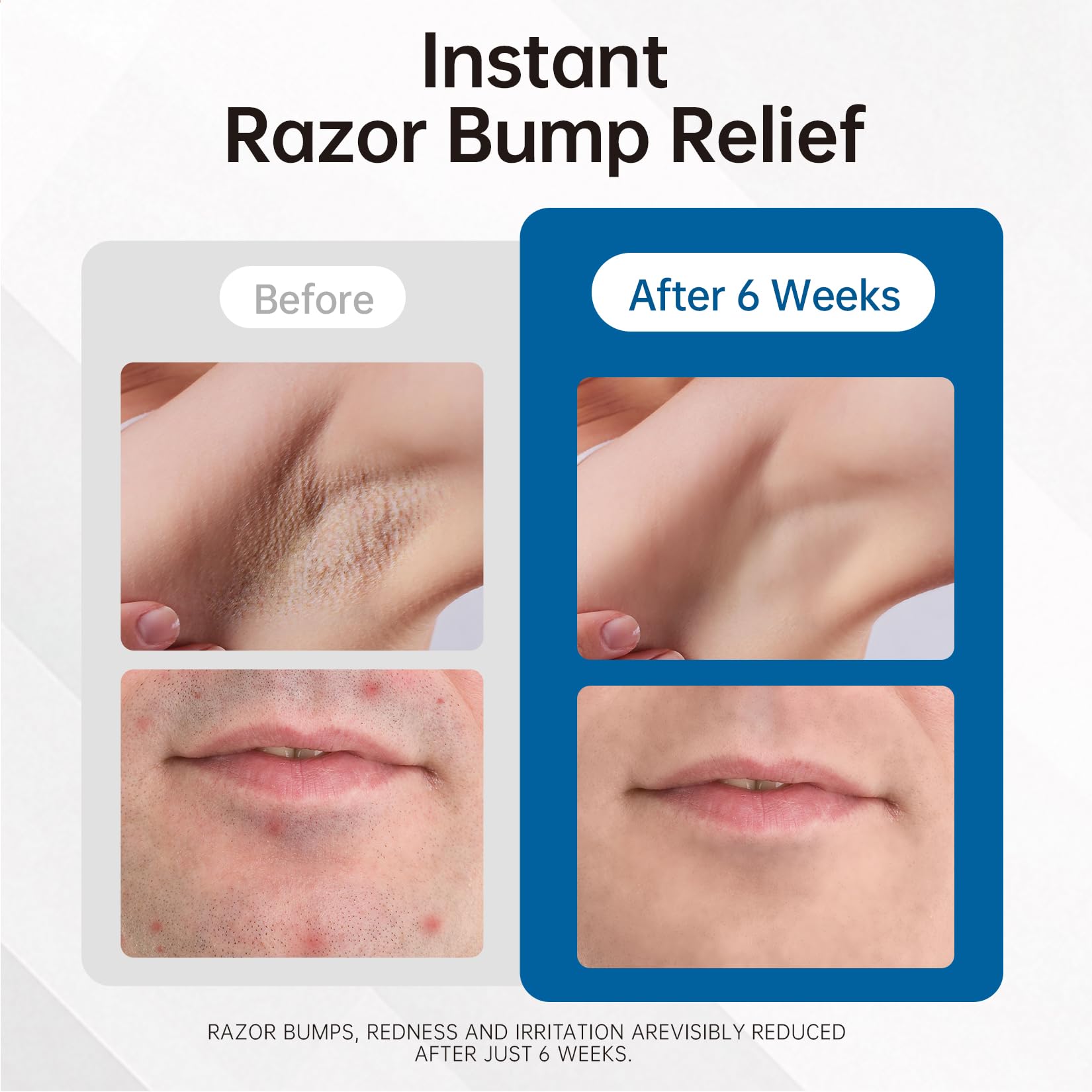 Morovan fast-absorbing serum texture shown, reducing irritation quickly.