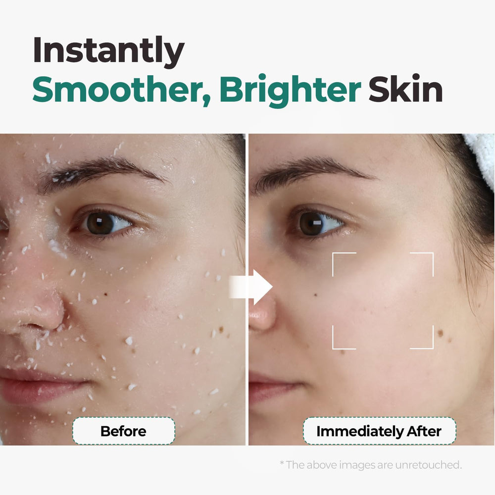 MOTHER MADE LHA exfoliating aqua peel gel used on body for smoother skin.