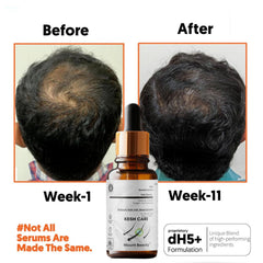 Nourishing blend highlights scalp care and follicle vitality