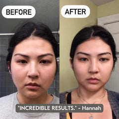 Mount Lai face massage serum applied with tool for smooth glide.