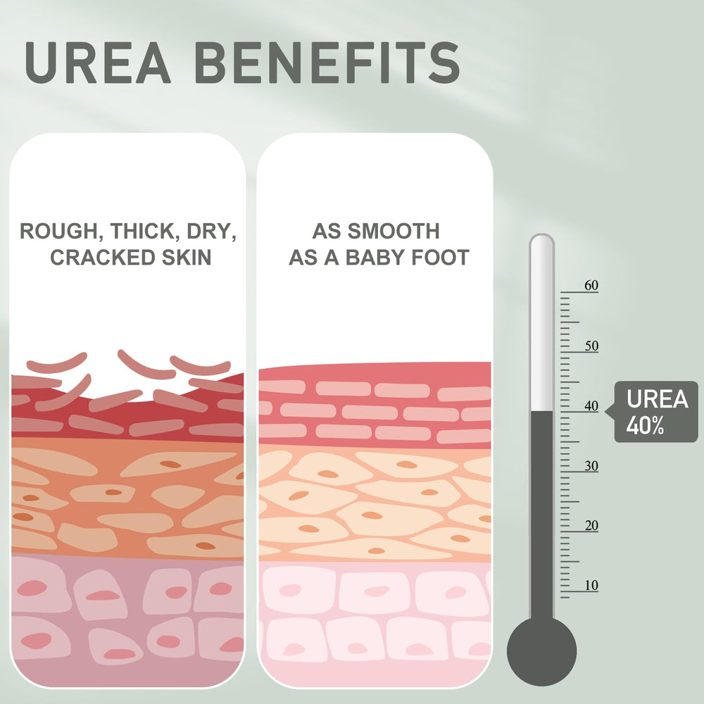 Mouriven Urea Cream 40% applying to heel showing exfoliating action for dry skin