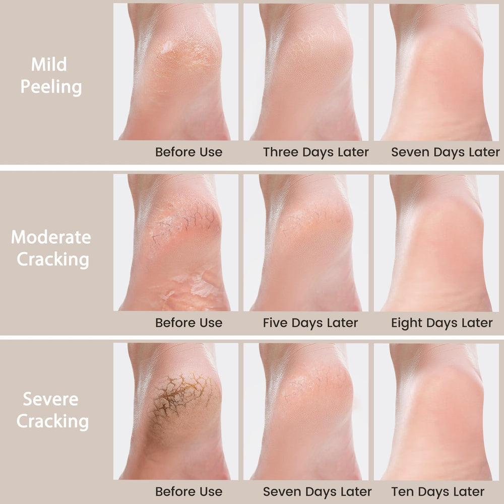 Mouriven Urea Cream 40% natural ingredients panel highlights glycerin, shea butter, jojoba oil