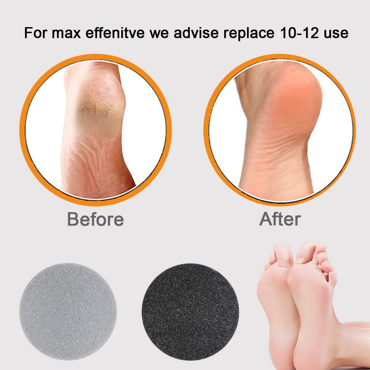 MoveLove foot care setup with replacement pads and accessories