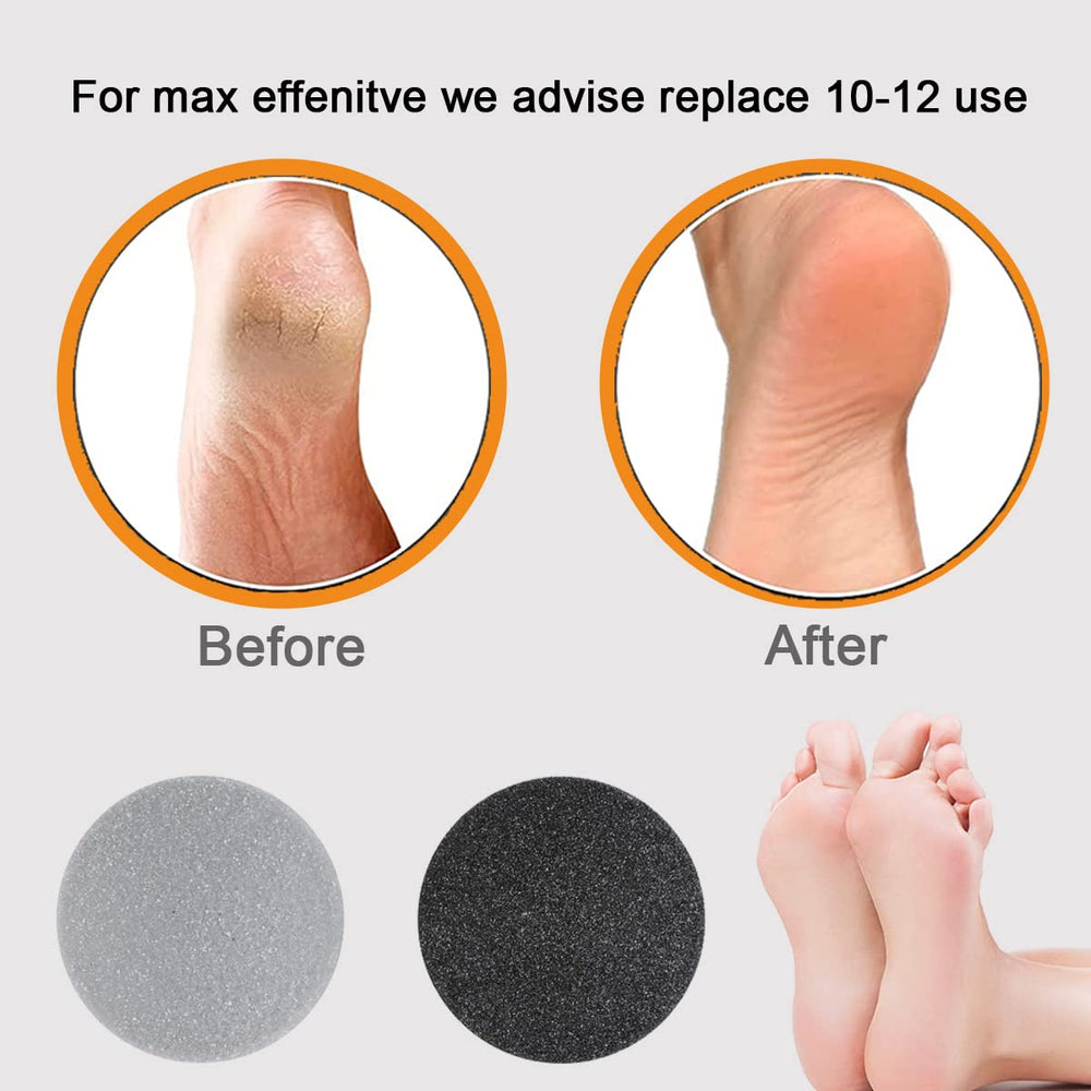MoveLove foot care setup with replacement pads and accessories