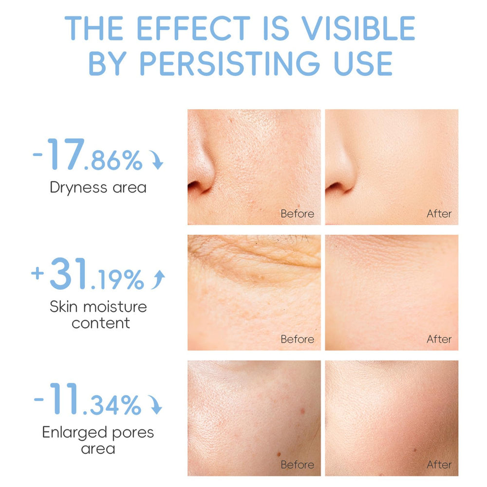 MrCuvaryas cleansing brush enables deeper, gentler cleansing