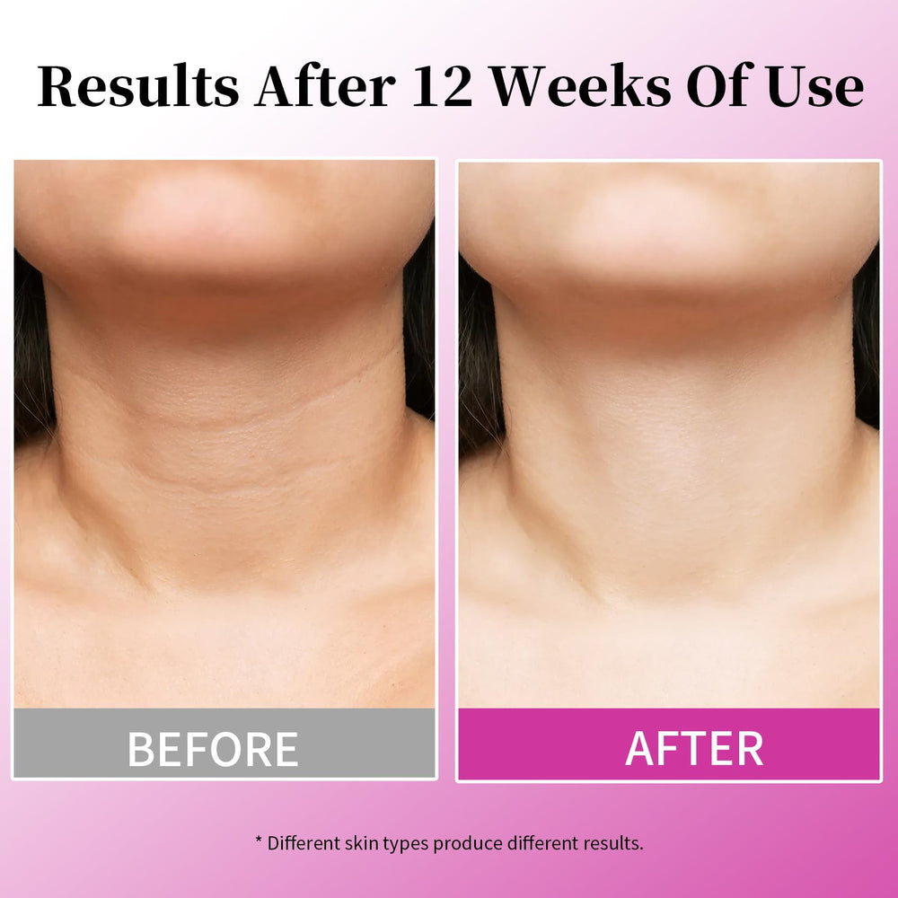 MRLILEI clinical results chart suggests texture and firmness improvements