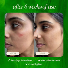 Mudita Earth Lactic Acid exfoliation refines texture gently