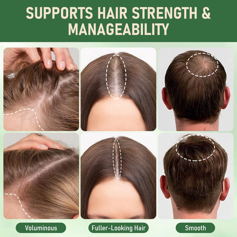 Muoyid rosemary hydrolyzed keratin shampoo pack on display promotes daily use for healthier roots