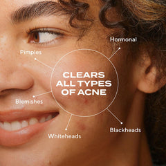 Murad Biome-Balancing Serum dropper in use for easy daily application