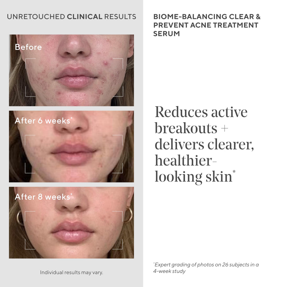 Murad Biome-Balancing Serum packaging emphasizes gentle, non-drying acne care