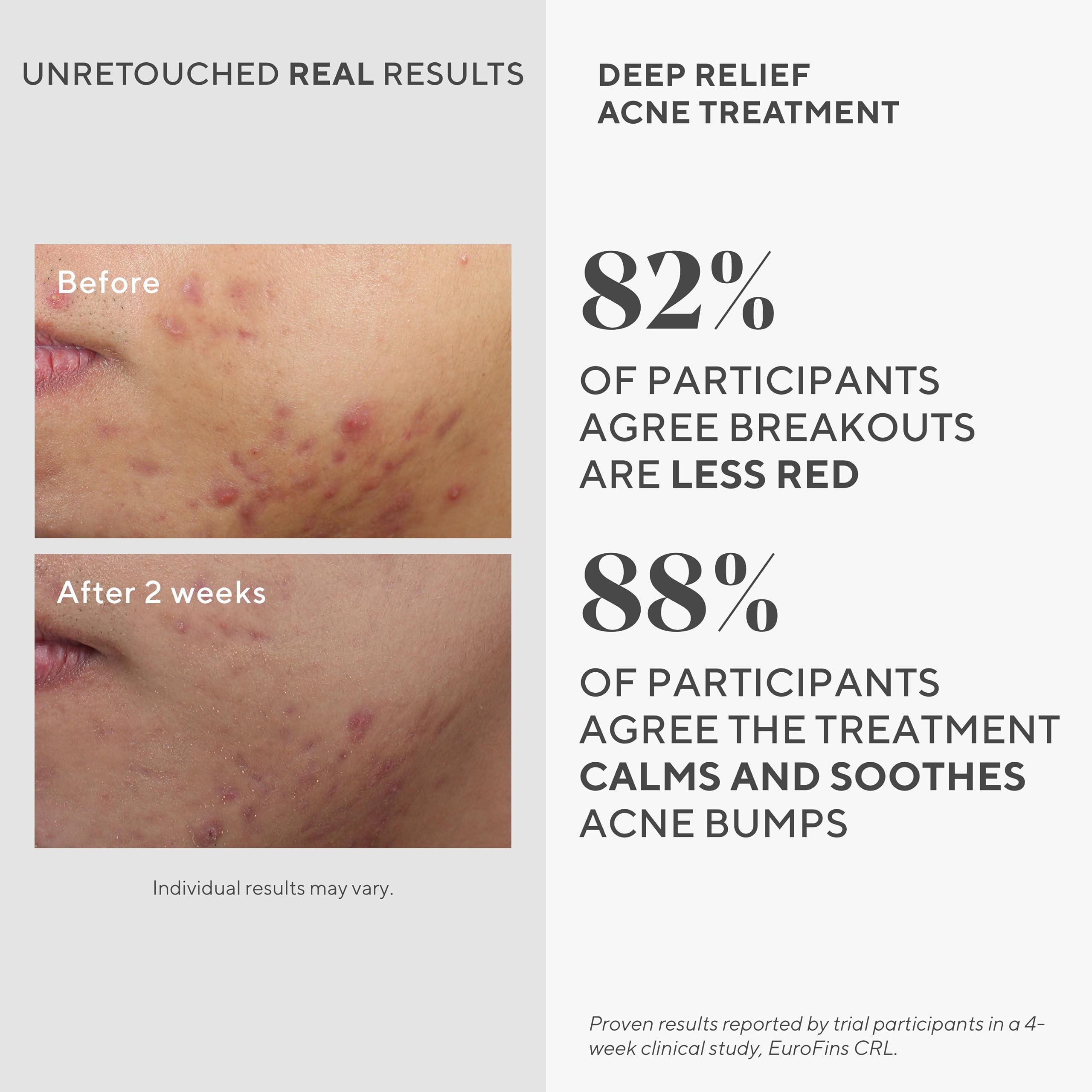Murad Deep Relief serum texture reveals a lightweight, invisible finish for day or night use.