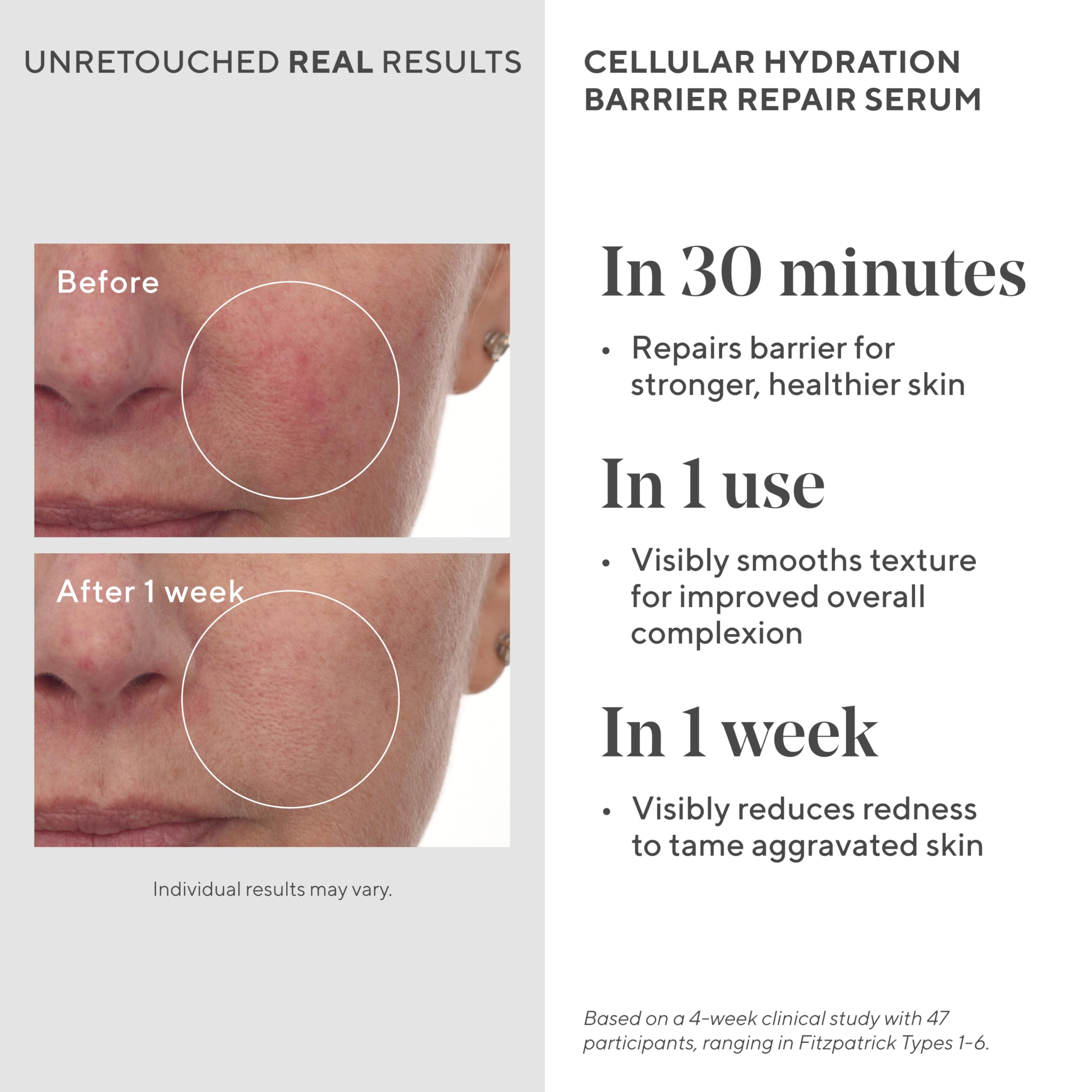 Murad Hydrate Trial Kit travel case close-up highlighting portability.