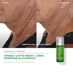 Murad Retinal ReSculpt refill packaging highlights sustainability.