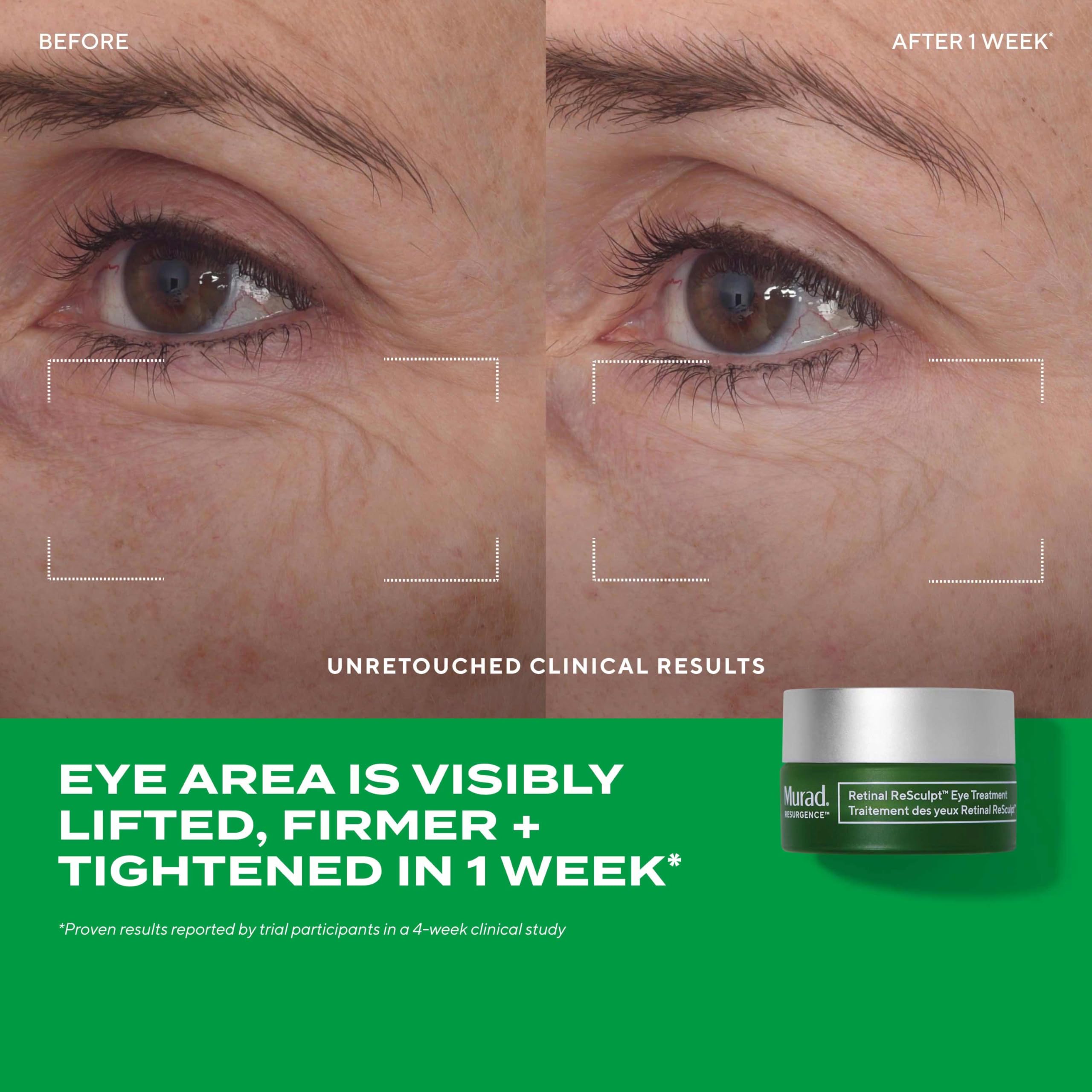 Open Murad Retinal Trial Kit showing serum and eye cream components.