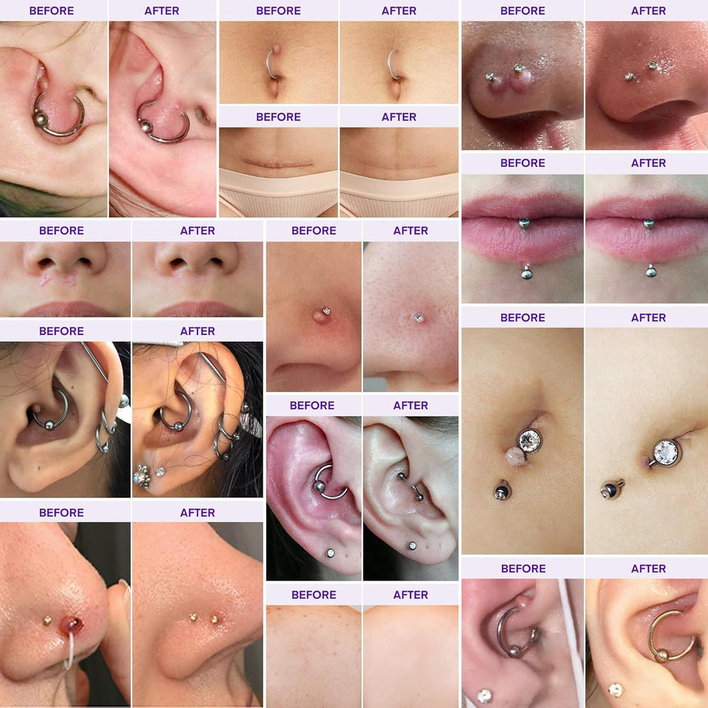 Murasaki Beauty piercing bump solution oil dispenser for precise application during aftercare