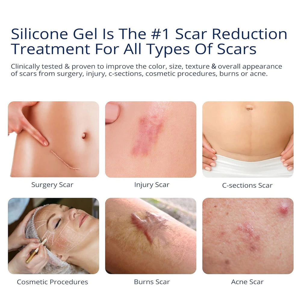 Murasaki Beauty silicone scar gel tubes closeup for fast-absorbing scar treatment