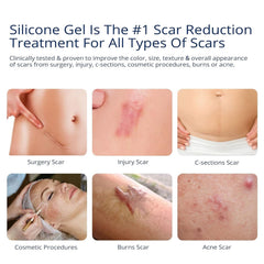 Murasaki Beauty silicone scar gel tubes closeup for fast-absorbing scar treatment