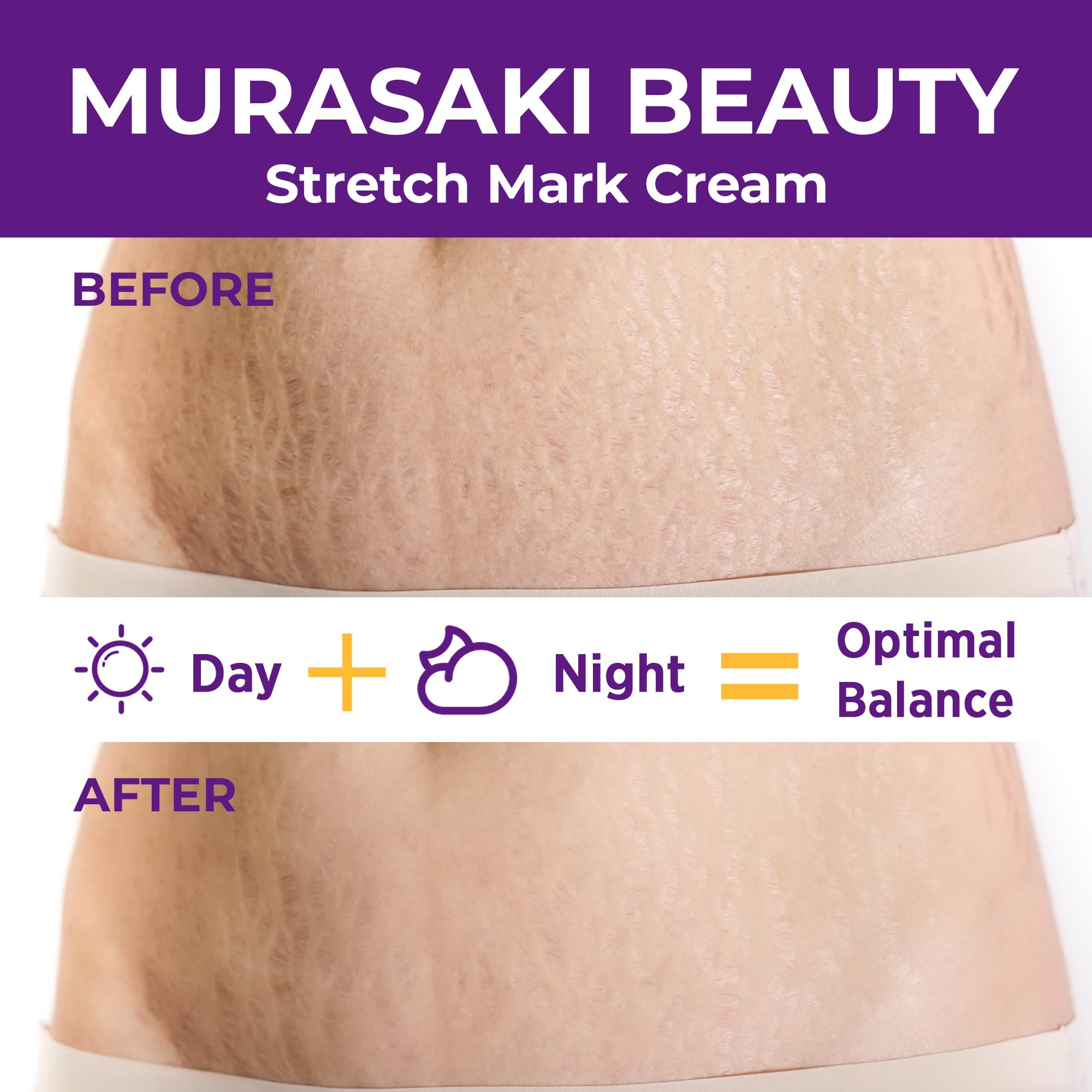 Murasaki Beauty formula with hyaluronic acid for hydration and softness