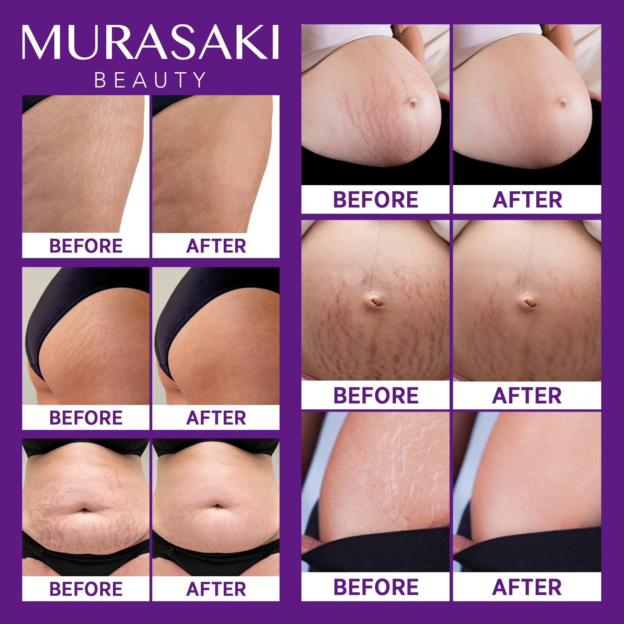 Murasaki Beauty lavender aroma providing a light, calming scent