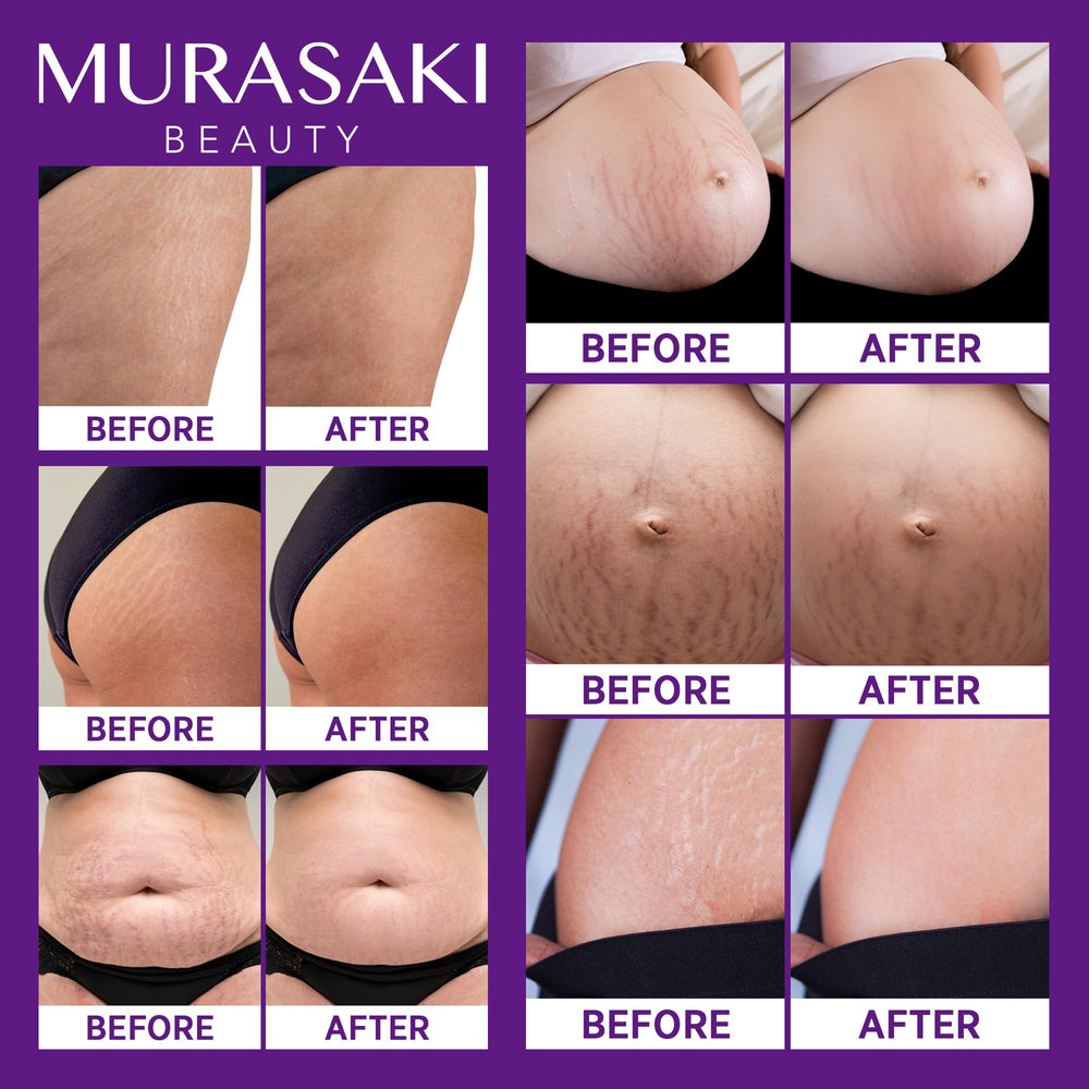 Murasaki Beauty lavender aroma providing a light, calming scent