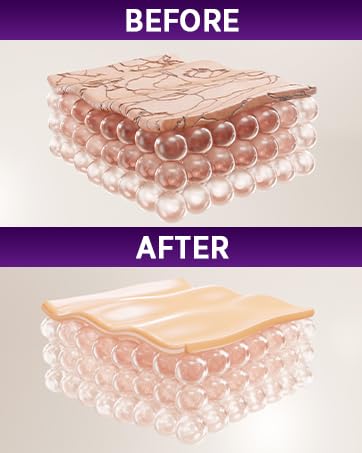 Murasaki Beauty stretch mark cream jar showing rich texture and quick absorption