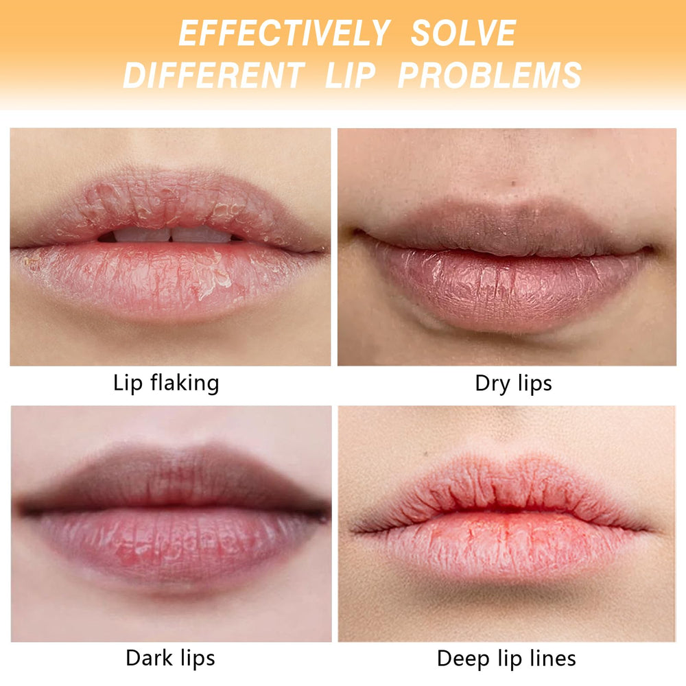 Before and after lips demonstrating smoother texture and improved tone