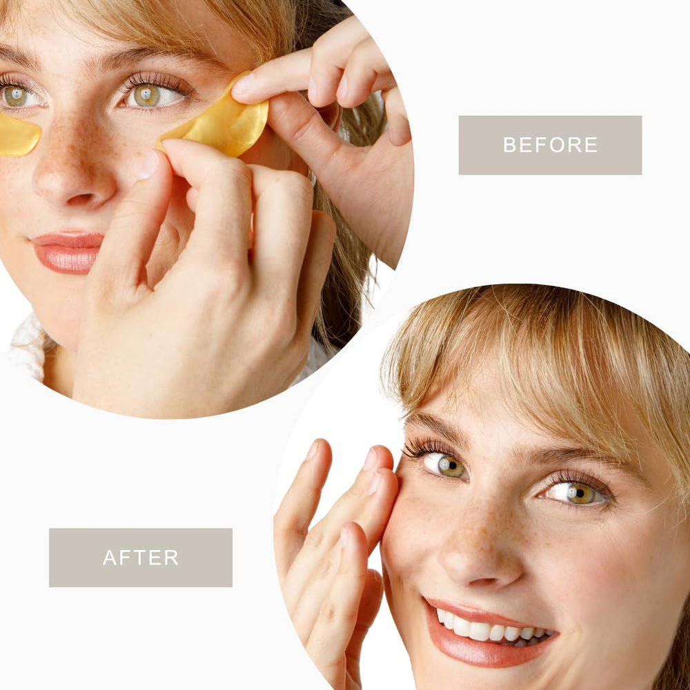 My Flexy gold eye patches add a luxe touch to self-care.