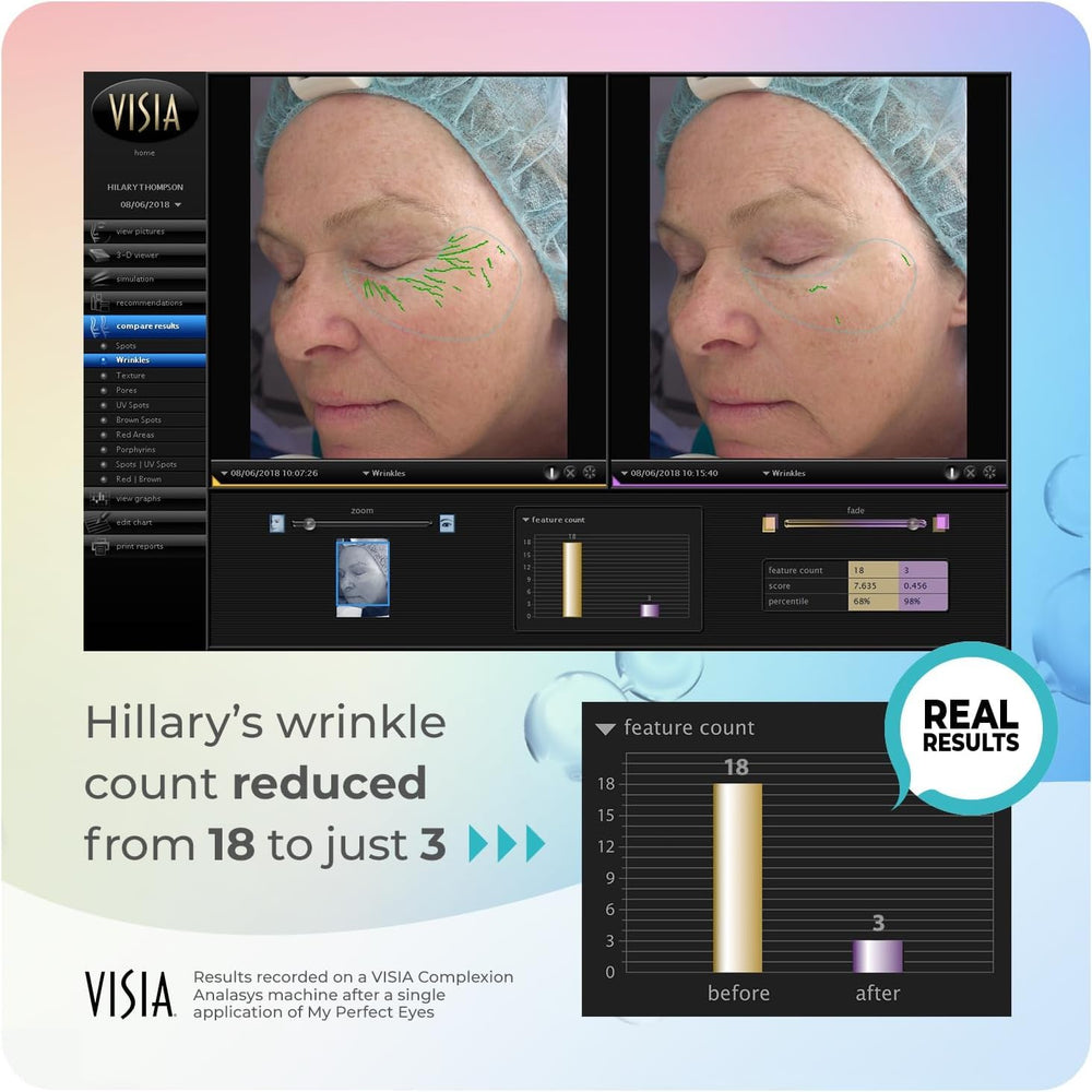 My Perfect Eyes soft finish after application for a refreshed look