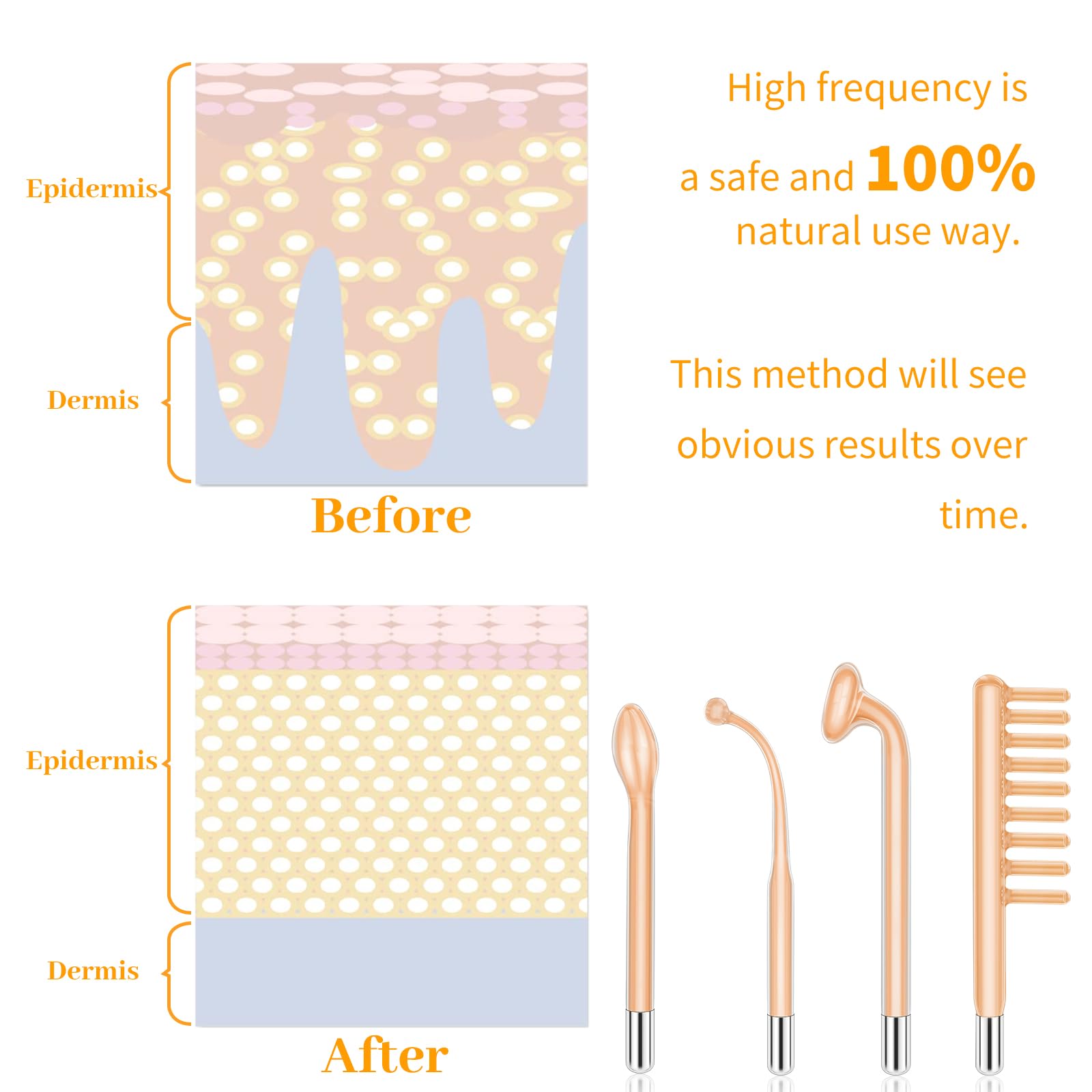 MYSWEETY High Frequency travel case demonstrates compact, travel-ready skincare kit