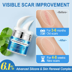Close-up of MythosFlow 6% dimethicone cream jar for advanced scar repair