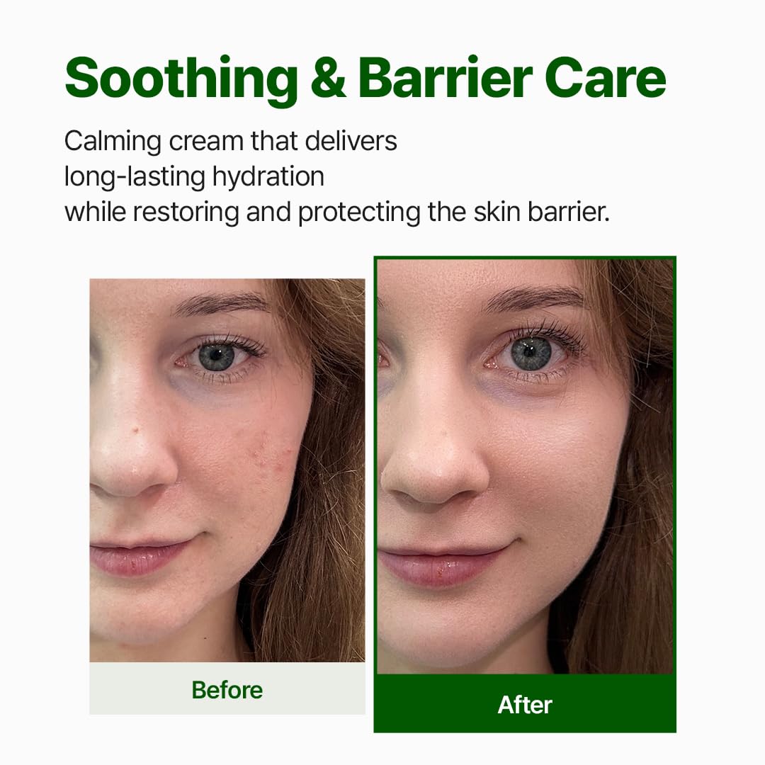 Cream swatch on skin showing gentle hydration and barrier support