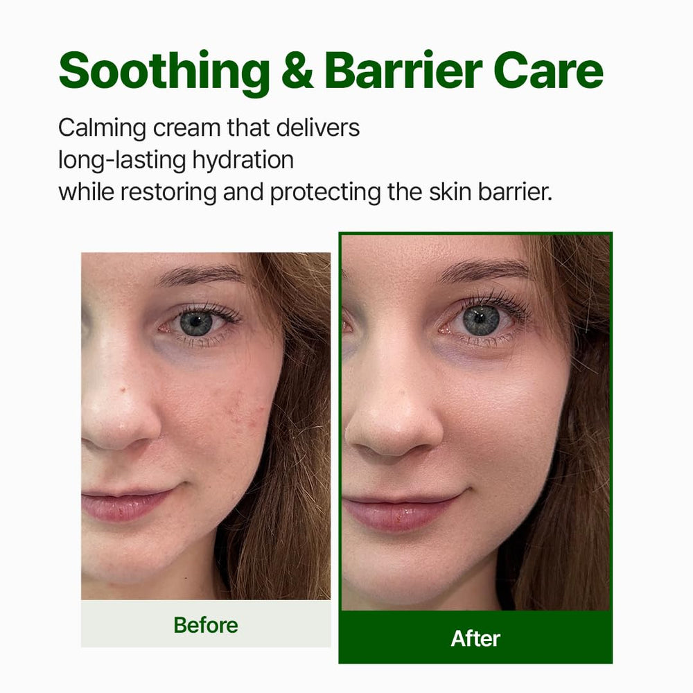 Cream swatch on skin showing gentle hydration and barrier support