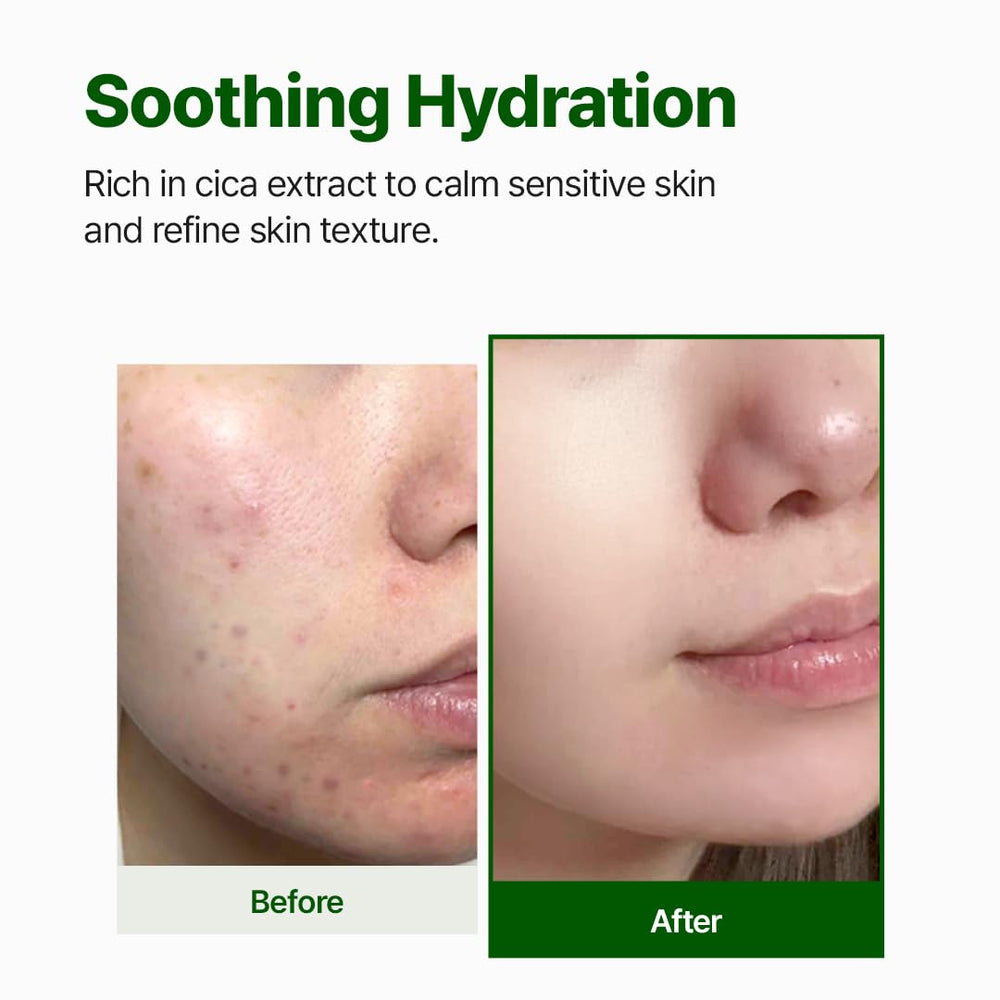 NACIFIC CICA PDRN First Toner Centella water close-up emphasizing skin-calming leaf extract.