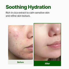 NACIFIC CICA PDRN First Toner Centella water close-up emphasizing skin-calming leaf extract.