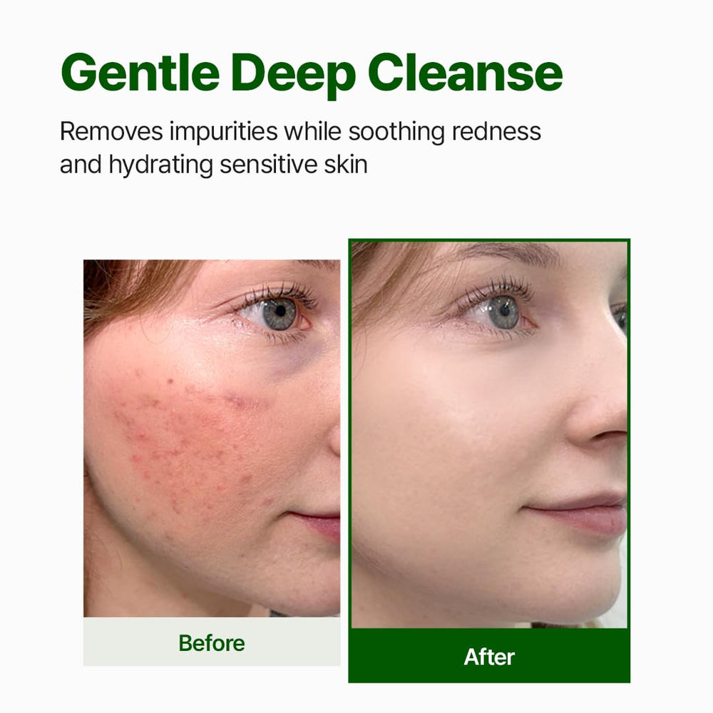 NACIFIC gel cleanser lather illustrates gentle cleansing without leaving residue